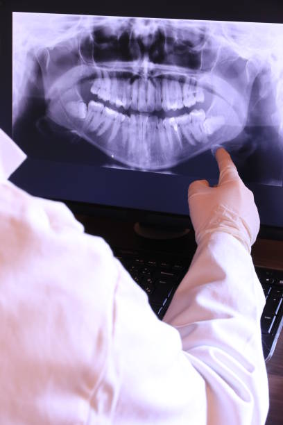 Best Emergency Treatment for Dental Infections or Abscesses in Bartlett, IL