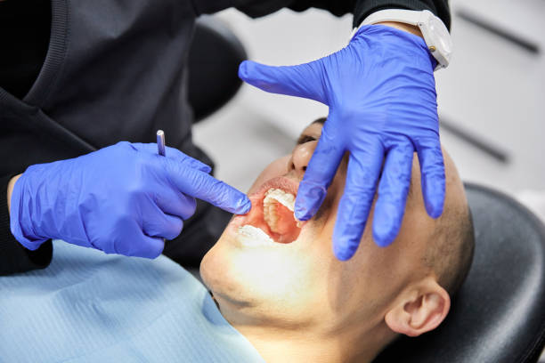 Best Emergency Dental Care for Broken or Chipped Teeth in Bartlett, IL