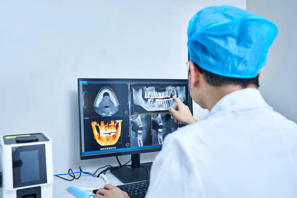 Best Emergency Tooth Extraction in Bartlett, IL